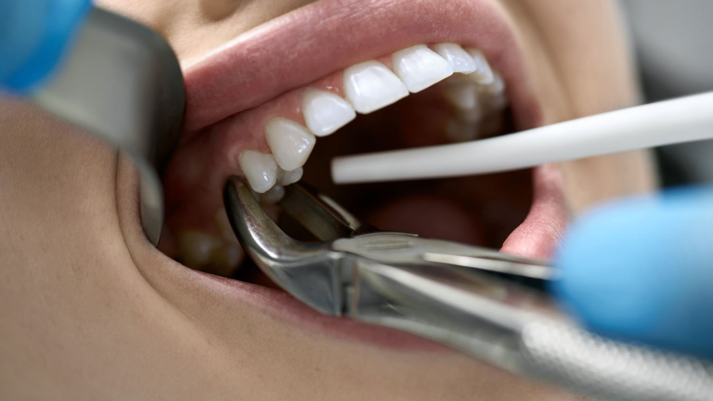Ozonated Oil Pulling Post-Tooth Extraction
