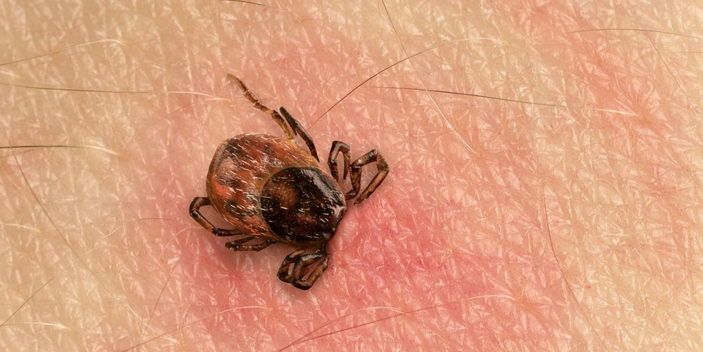 Ozonated Oils in Lyme Disease Management