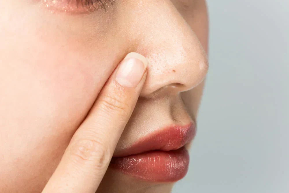 Clogged Pores: Pathophysiology, Contributing Factors, and the Potential Role of Ozonated Oils in Skin Care