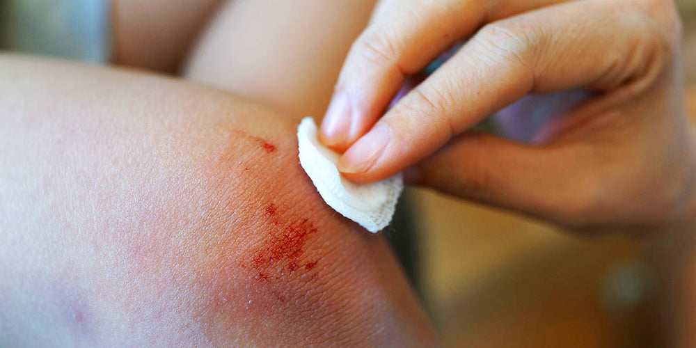 Natural First-Aid at Home: How Ozonated Oils Can Help